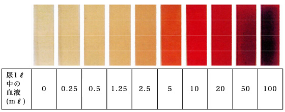 血尿 の 色 ピンク